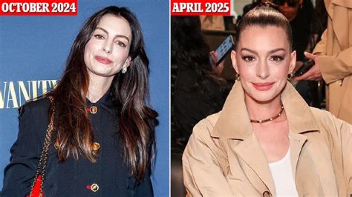 Anne Hathaway’s Plastic Surgery In 2 Rhinoplasty, Boob Job, & Botox Injection Rumors Examined!