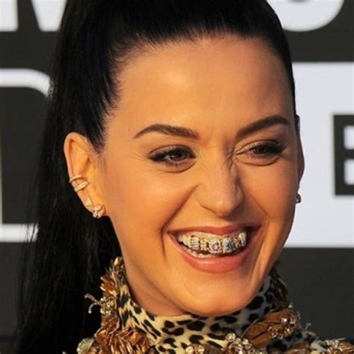 Does Katy Perry Have Braces?